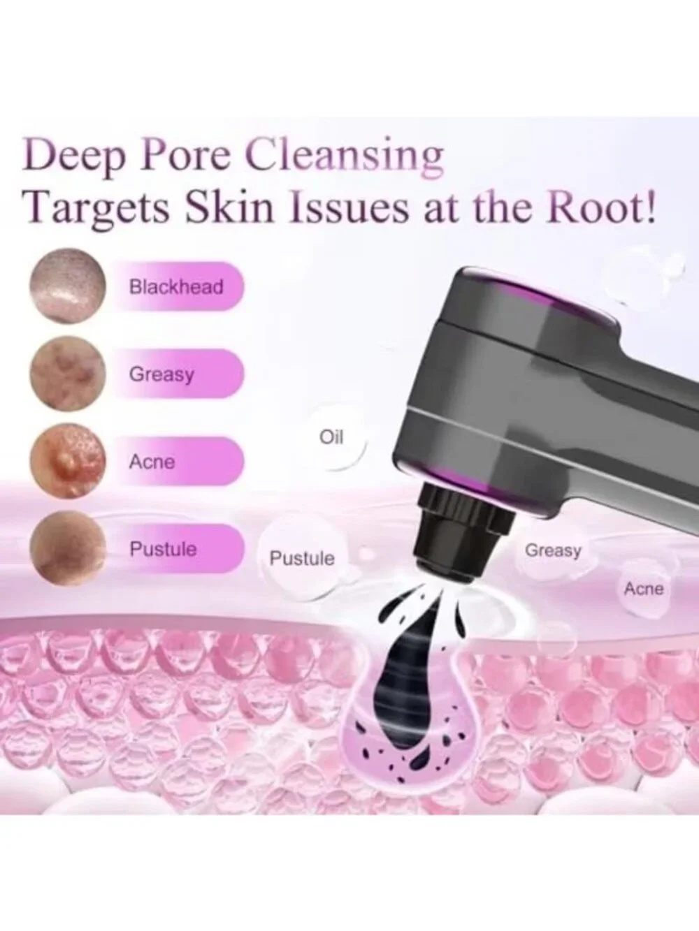 Heated Blackhead Remover Pore Vacuum 5 Heads 3 Suction Levels Facial NIB
